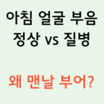 아침 얼굴 부음 정상 vs 질병 왜 맨날 부어? 텍스트 이미지